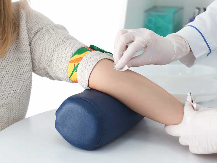 Testul de sange RDW si interpretare rezultate
