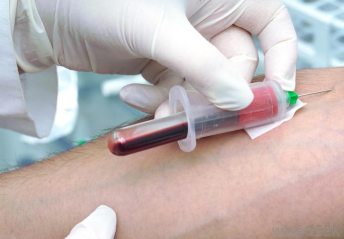 test de sange monicite