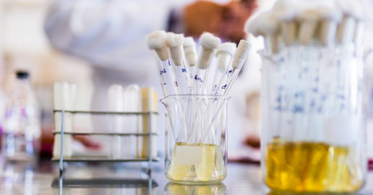 Sedimente in urina: Ce inseamna cu adevarat (bazat pe stiinta)