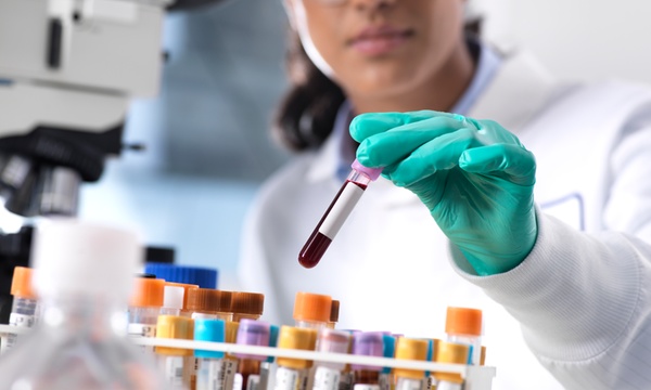 Analiza urinara: Cum se recolteaza urina si ce spune despre sanatatea ta