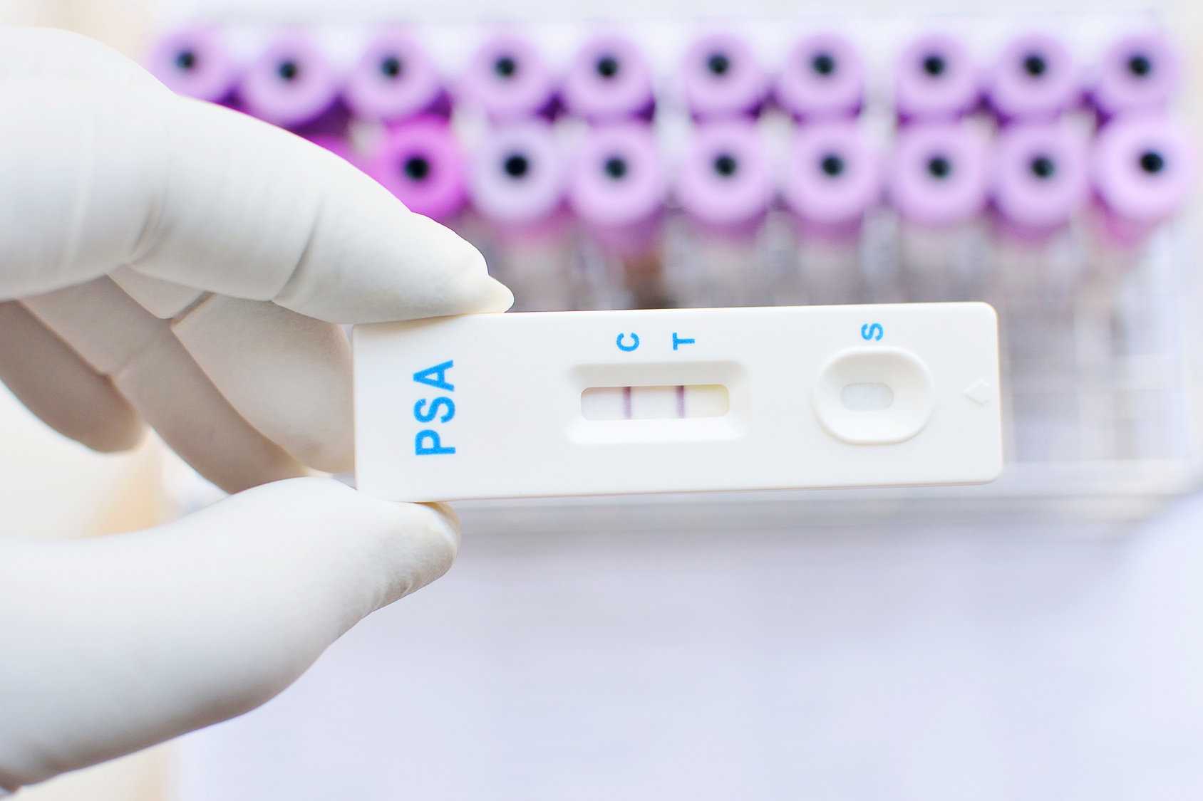 PSA total (antigen specific prostatic) - Detalii analiza | Bioclinica