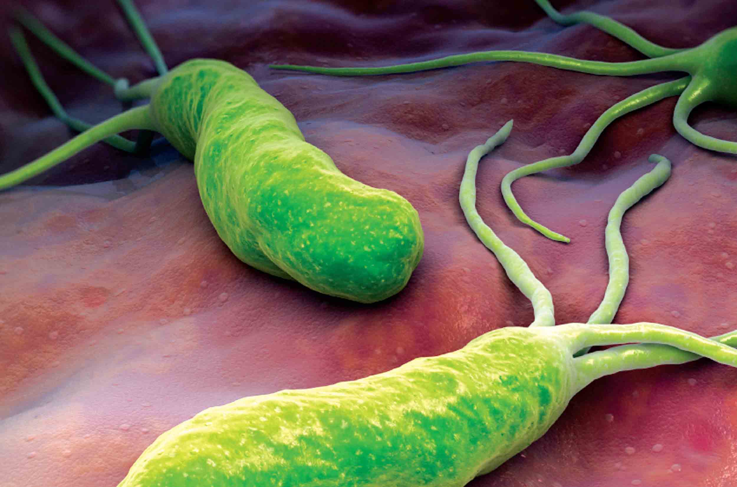 Helicobacter Pylori - Cauze, Simptome & Tratament
