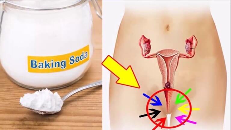 Cum se folosește bicarbonatul de sodiu pentru a scăpa de candida