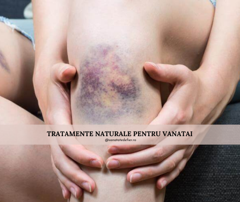 Cum sa scapi de vanatai in mod natural (articol sustinut de dovezi stiintifice)