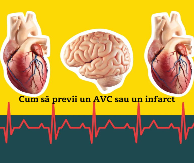 Cum sa reduci la minim riscul de atac de cord sau accident vascular cerebral